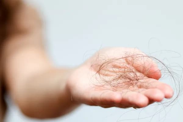 Exercises for Hair Fall