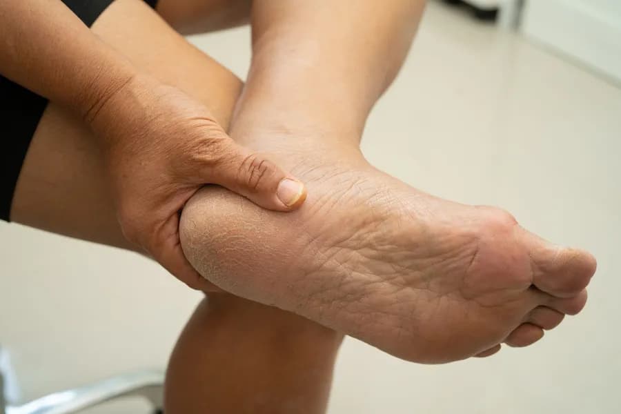 Exercises for Heel Pain