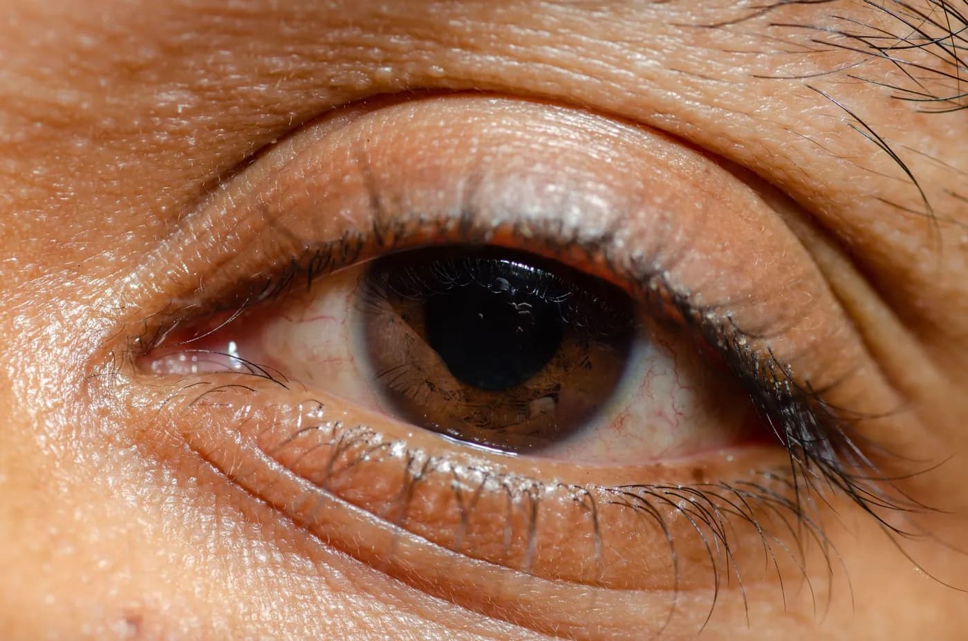 Macro close-up of a human eye with a brown iris, illustrating the eyelid muscles targeted by strengthening exercises